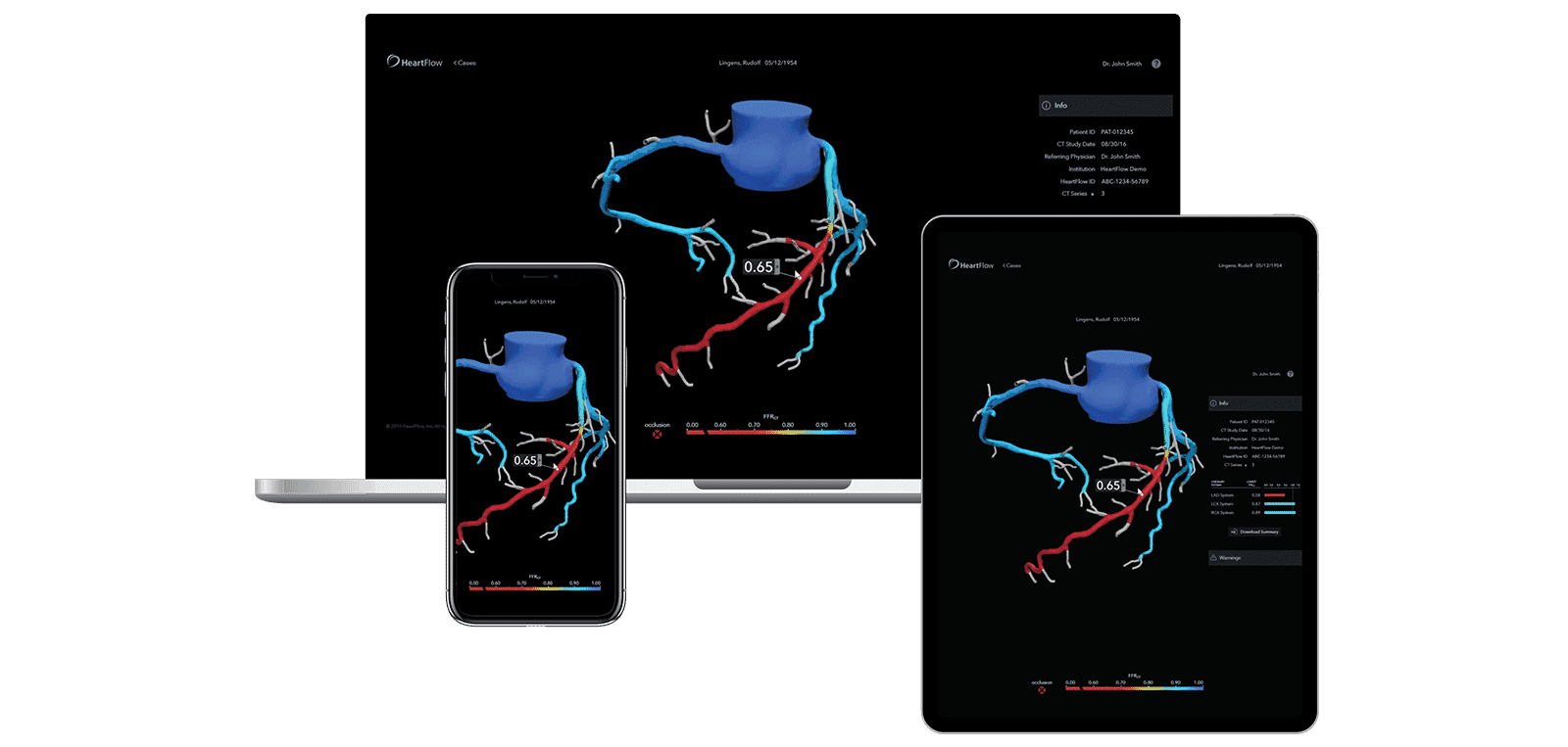IMage of IFU content for the HeartFlow Analysis